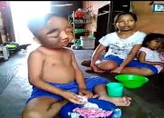 Rahmad Penderita Cacat Butuh Uluran Tangan Untuk Berobat