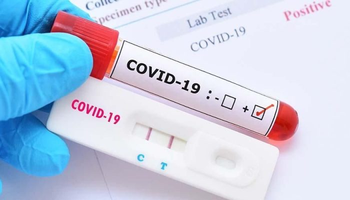 Di Sibolga Jumlah Pasien Yang Positif COVID-19 Menjadi 15 Orang