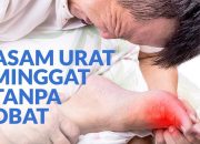5 Cara Menurunkan Kadar Asam Urat Tanpa Obat
