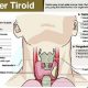 Tanda-tanda Kanker Tiroid yang Perlu Diwaspadai. (Int)