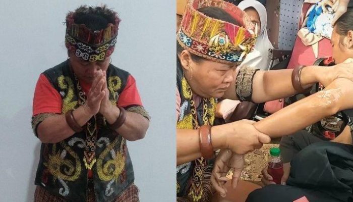 Pengobatan Alternatif Ida Dayak Tengah Viral di Media Sosial, Ini Tanggapan Dokter Ortopedi