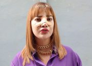 Irma Dharmawangsa menjalani operasi hidung di Jakarta Utara